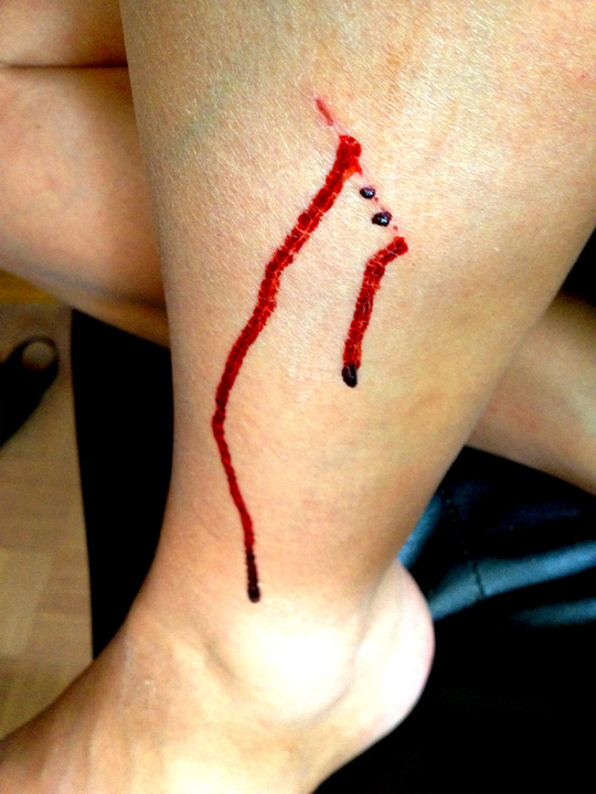 bleeding leg